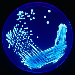 شناسایی باکتری لژیونلا در آب بیمارستان و استخرها